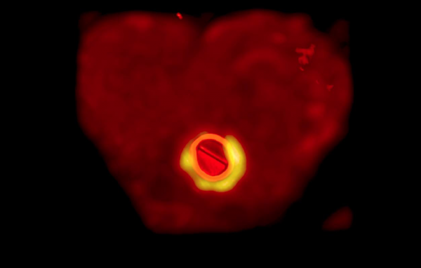 «Море клеток» и «сияние в сердце»: конкурс научных фото системы кровообращения